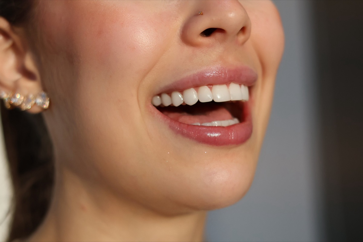Estética Dental — sorriso perfeito