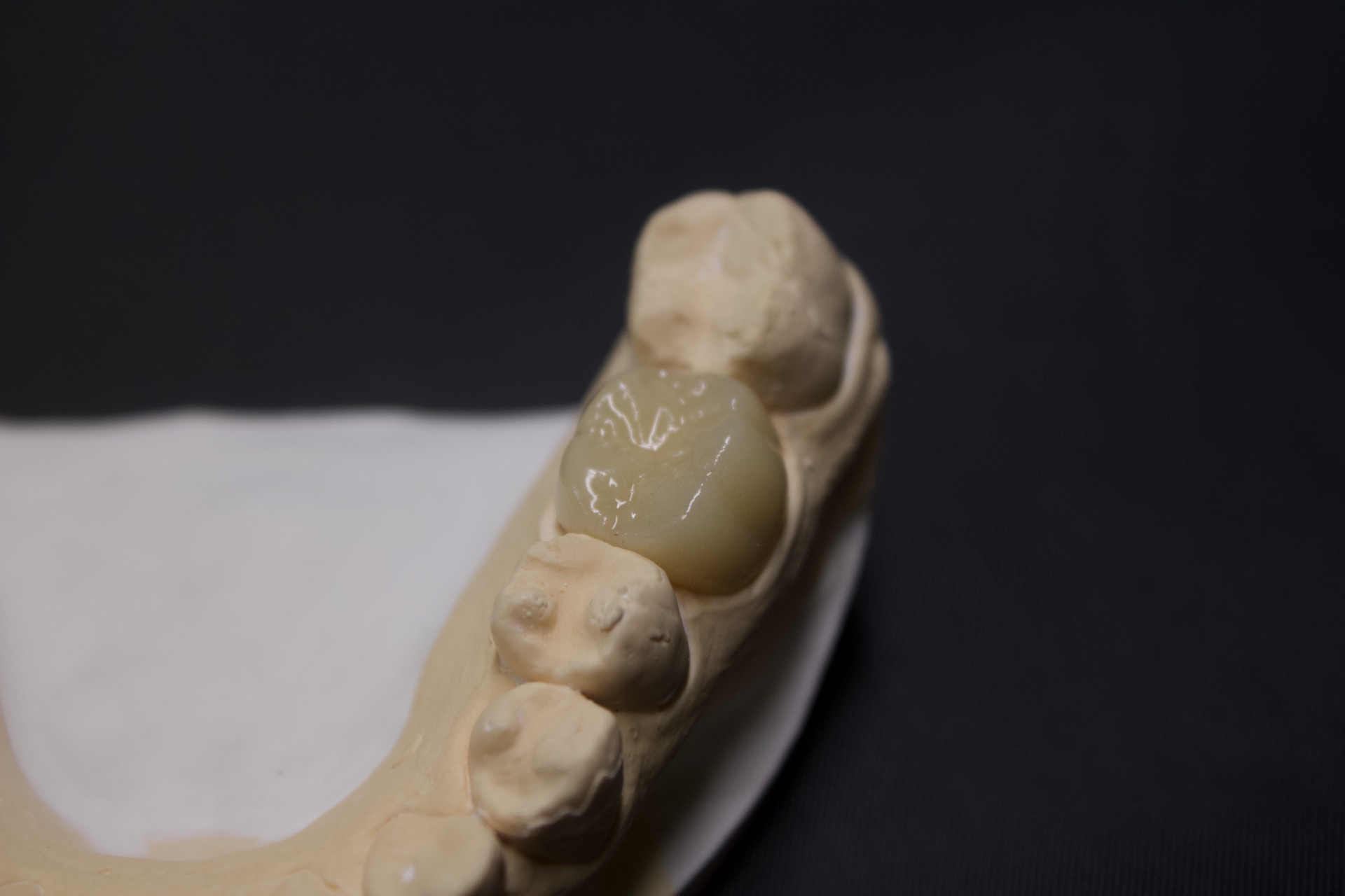 Prótese Dentária — FCA Odontologia