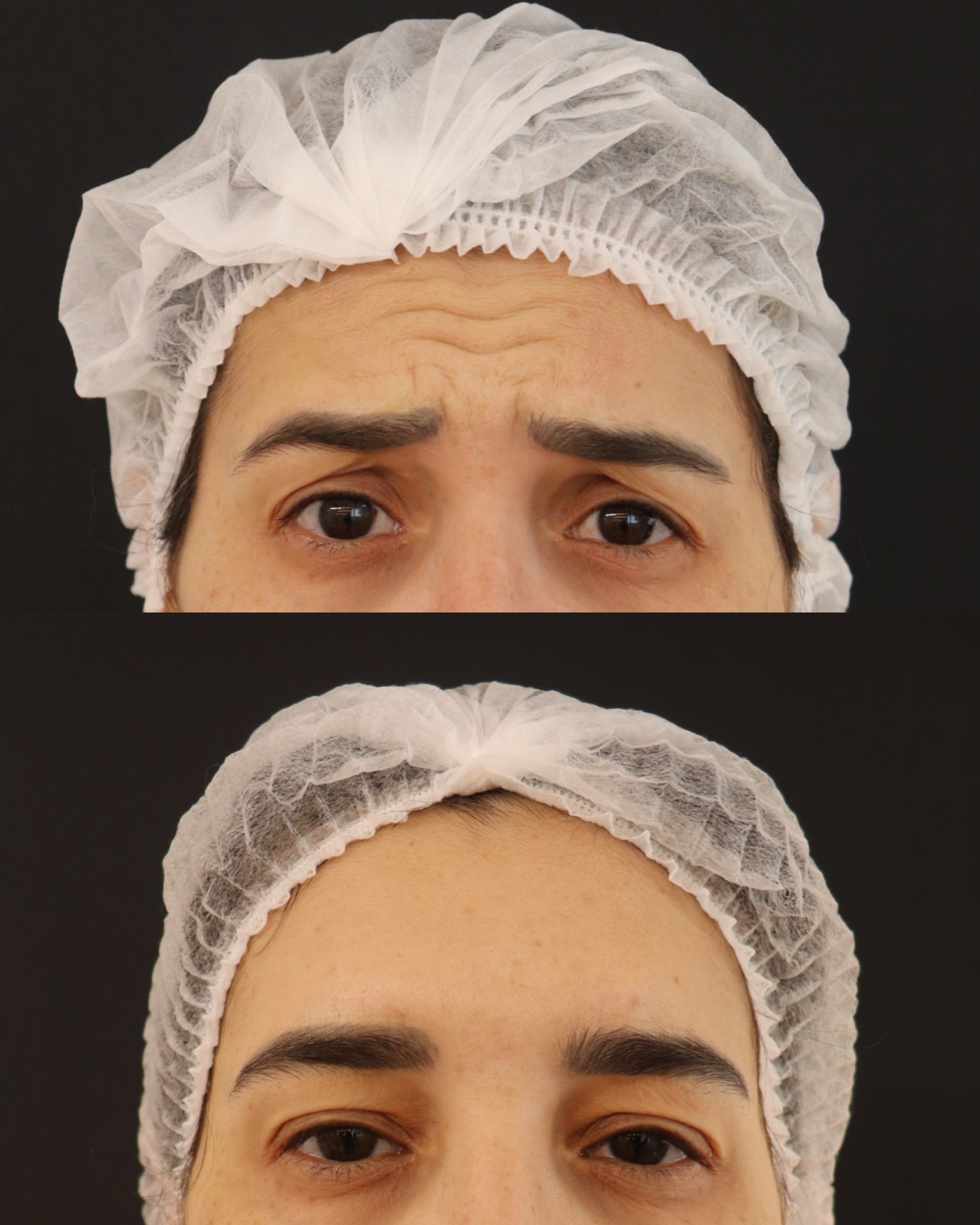 Resultado Harmonização Orofacial — FCA Odontologia